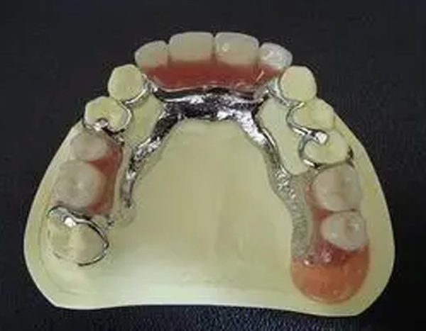 Frmework with Acrylic teeth