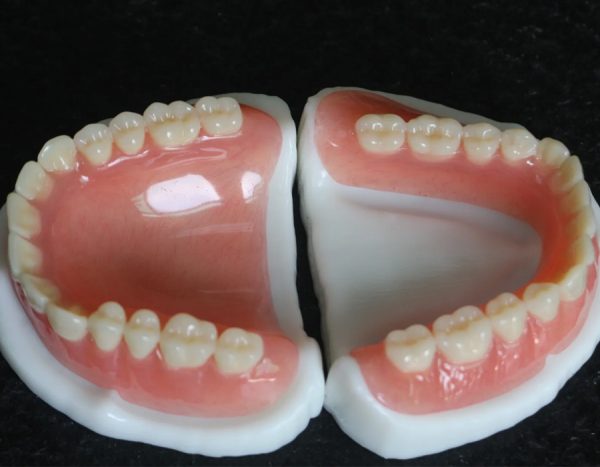 Full Arch Acrylic Denture