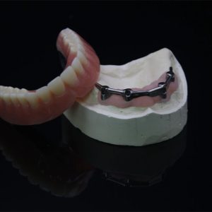 Implant Bar
