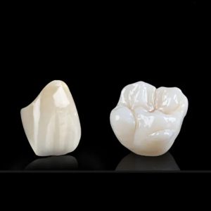 Zirconia Crowns